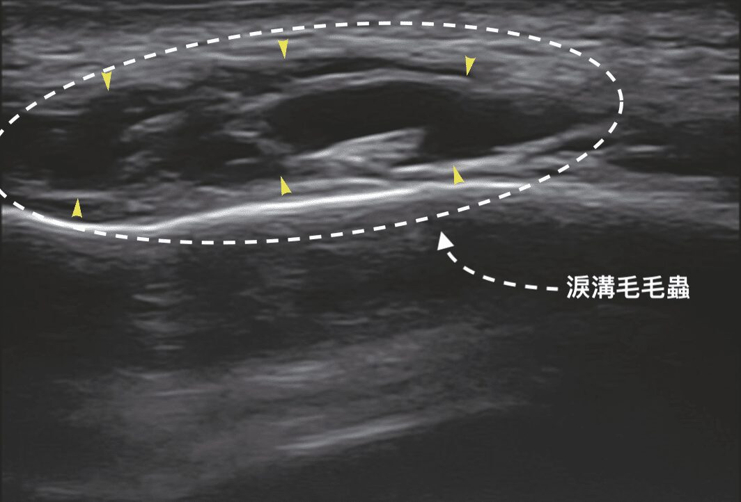 image 19 金蘋果美學診所｜歐家宏醫師