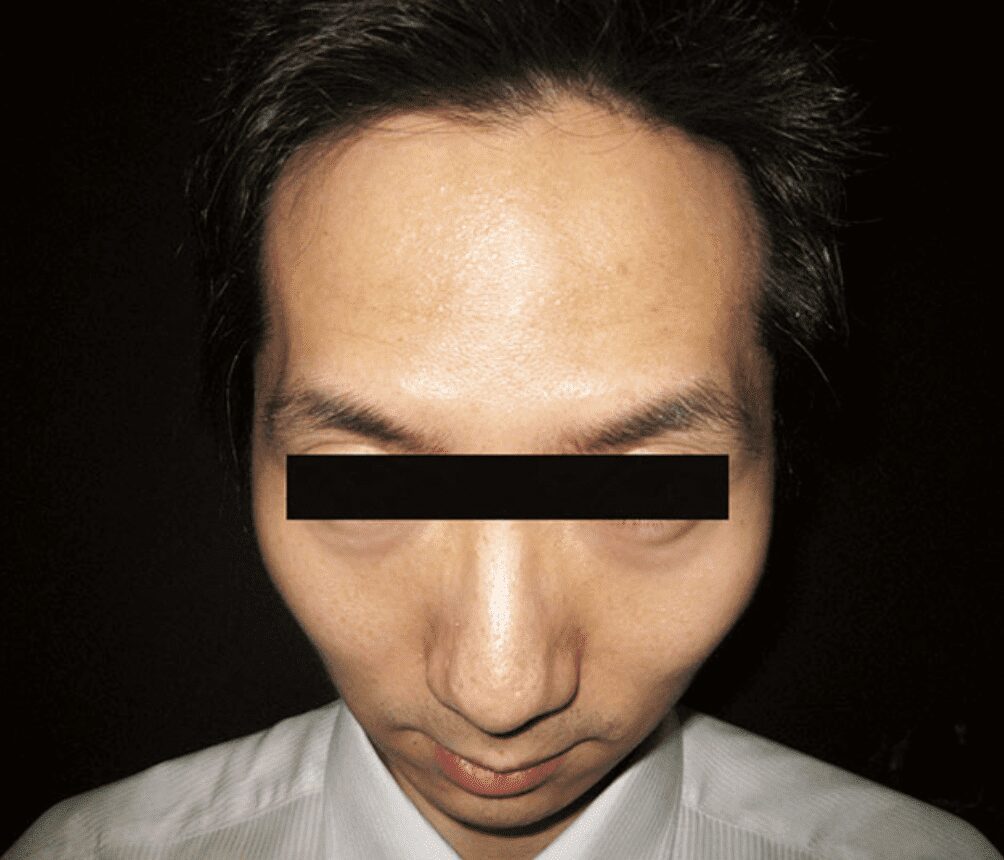image 25 金蘋果美學診所｜歐家宏醫師
