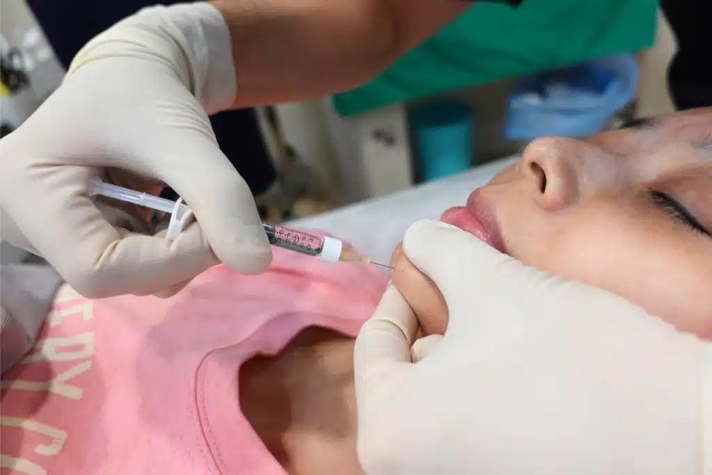 rejeunesse chin 1 金蘋果美學診所｜歐家宏醫師