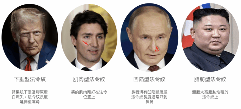 法令紋類型