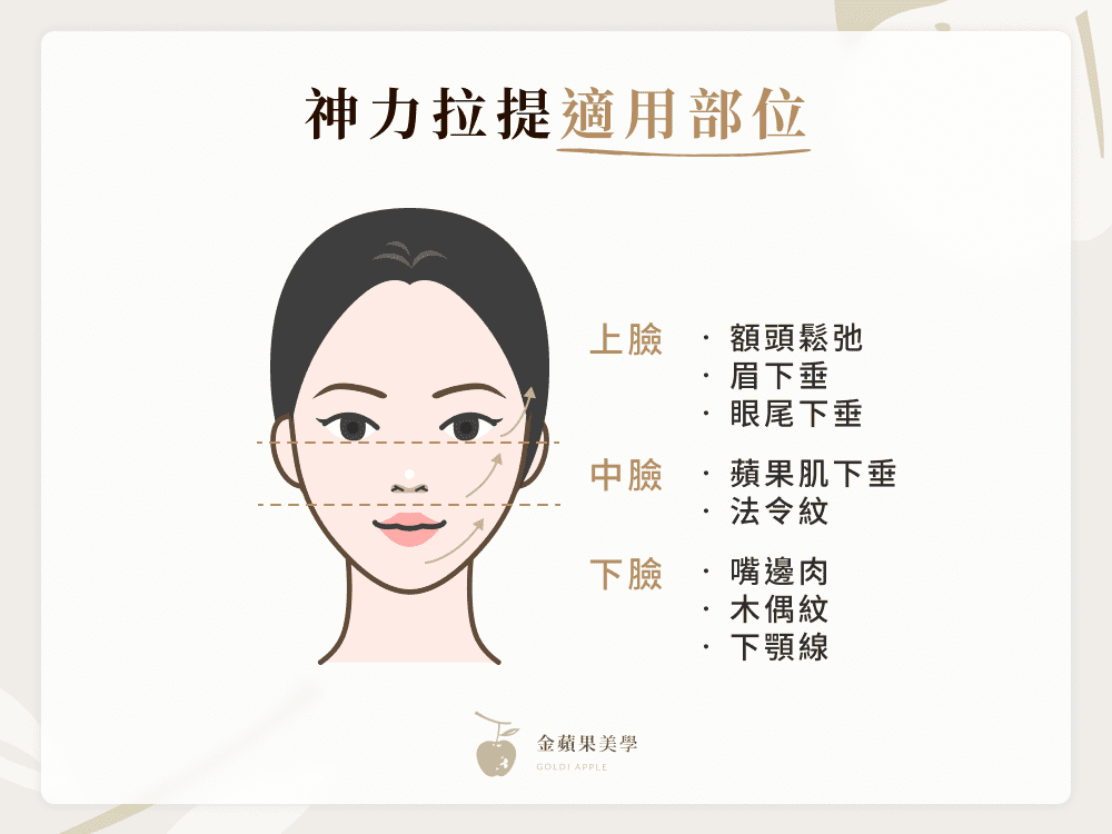 神力拉提效果好嗎?線材優勢、費用、案例分享,讓你告別鬆弛下垂 3 神力拉提適用部位