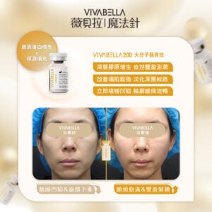 240902薇貝拉 原氣滿滿每一天02 金蘋果美學診所｜歐家宏醫師