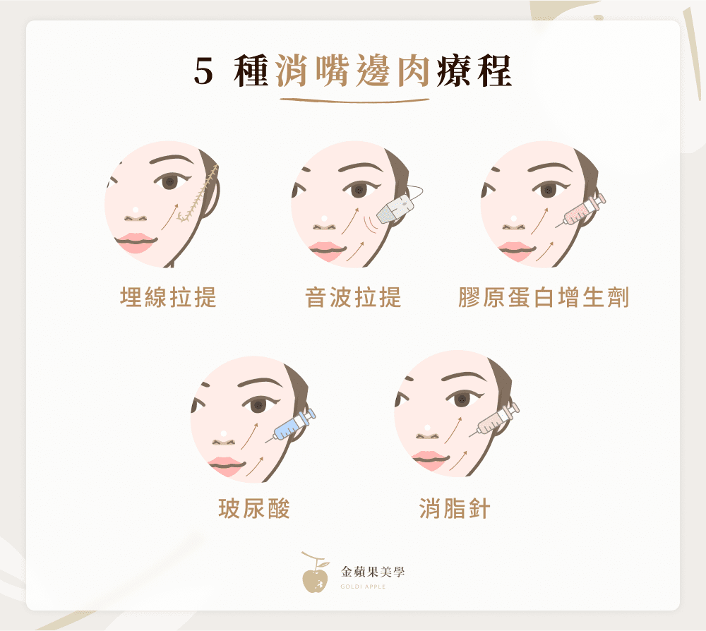 嘴邊肉改善怎麼做?5大醫美療程、4招預防方法不藏私公開! 4 5 種消嘴邊肉療程