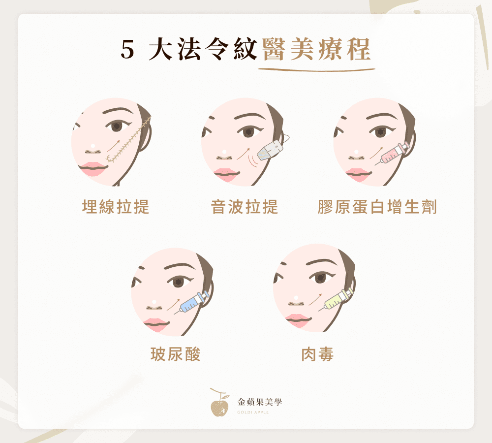 法令紋醫美有哪些?一文帶你掌握4種法令紋類型與適合療程! 4 5 大法令紋醫美療程