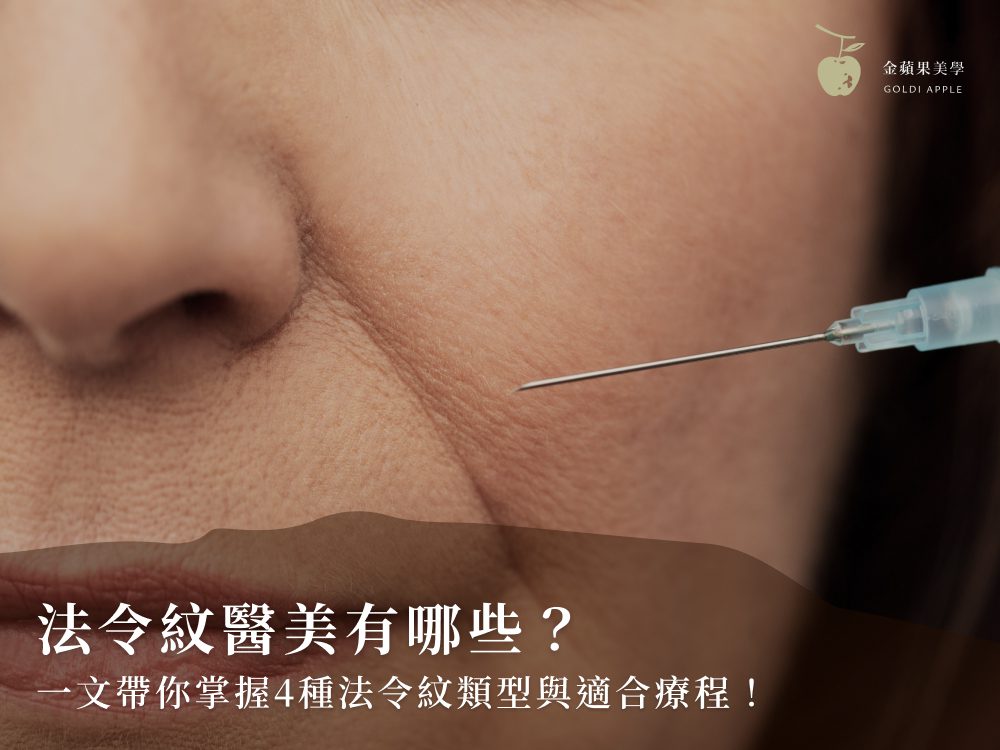 法令紋醫美有哪些?一文帶你掌握4種法令紋類型與適合療程! 2 法令紋醫美有哪些?一文帶你掌握4種法令紋類型與適合療程!