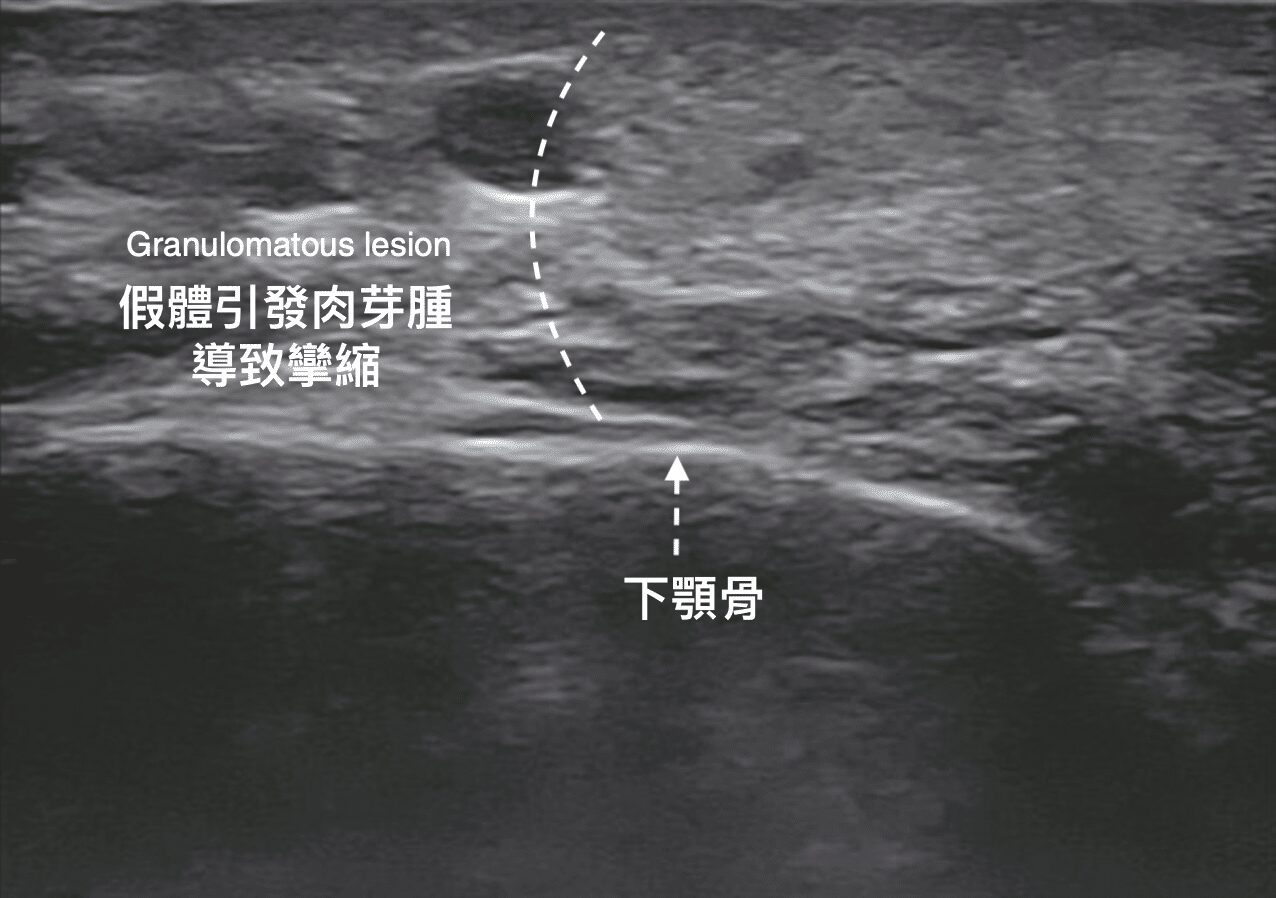Screenshot 2023 08 03 at 15.20.36 金蘋果美學診所｜歐家宏醫師