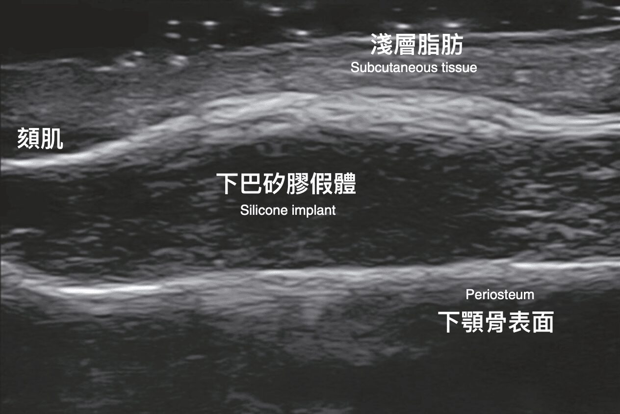 image 24 金蘋果美學診所｜歐家宏醫師