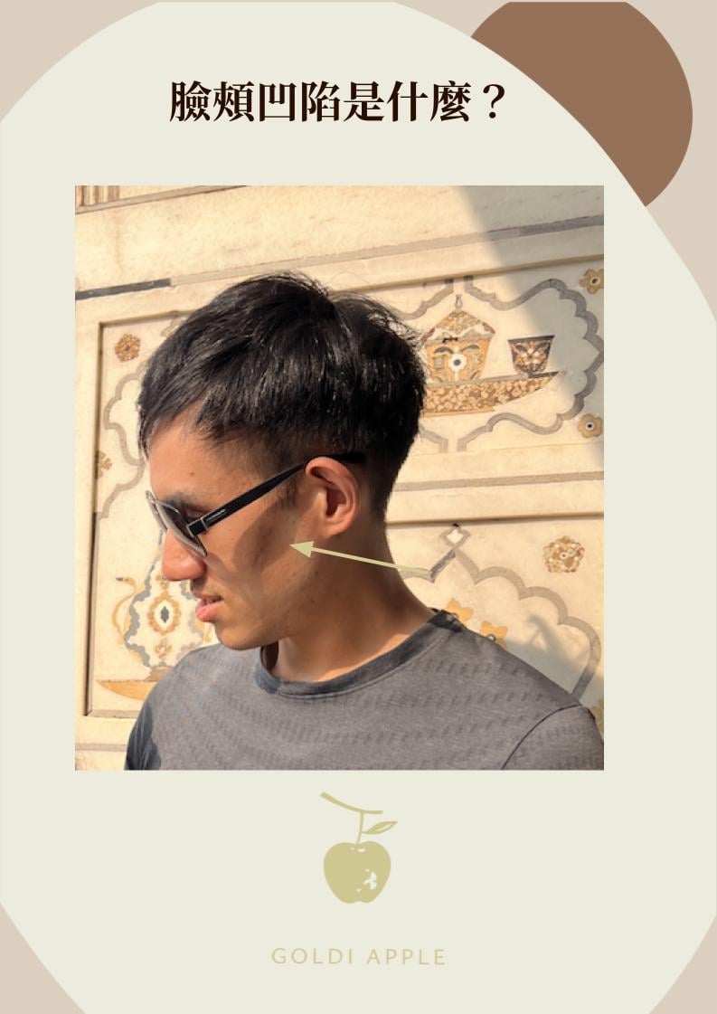 臉頰凹陷是什麼