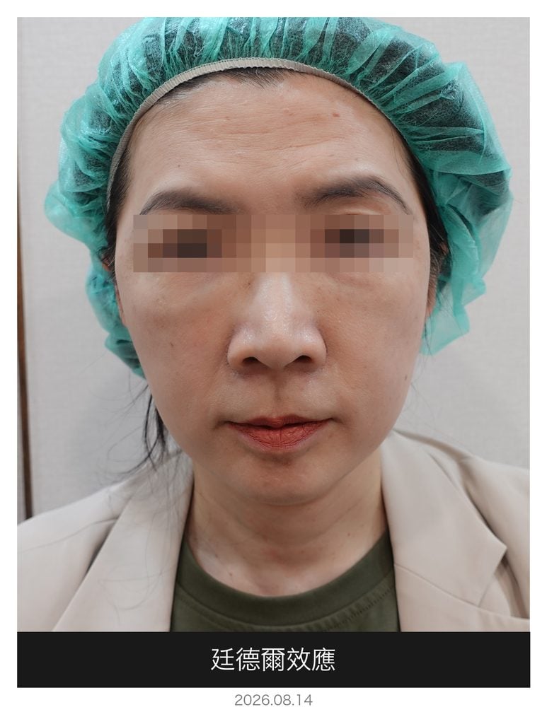 廷德爾效應 眼下藍藍的