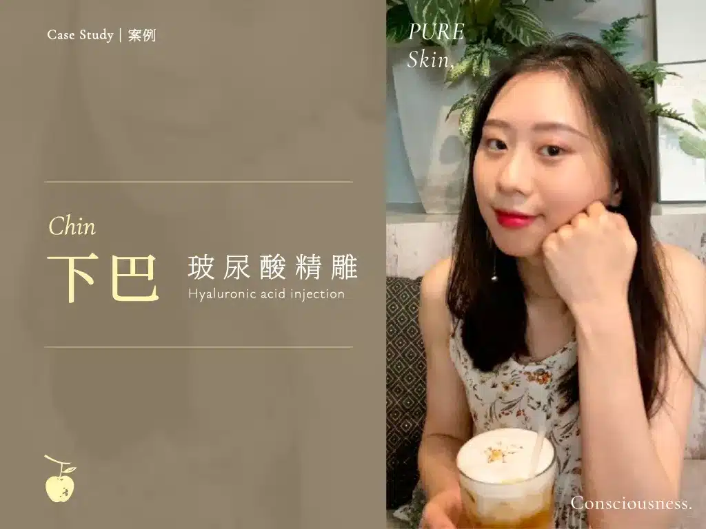 home casestudy chin 01 金蘋果美學診所｜歐家宏醫師