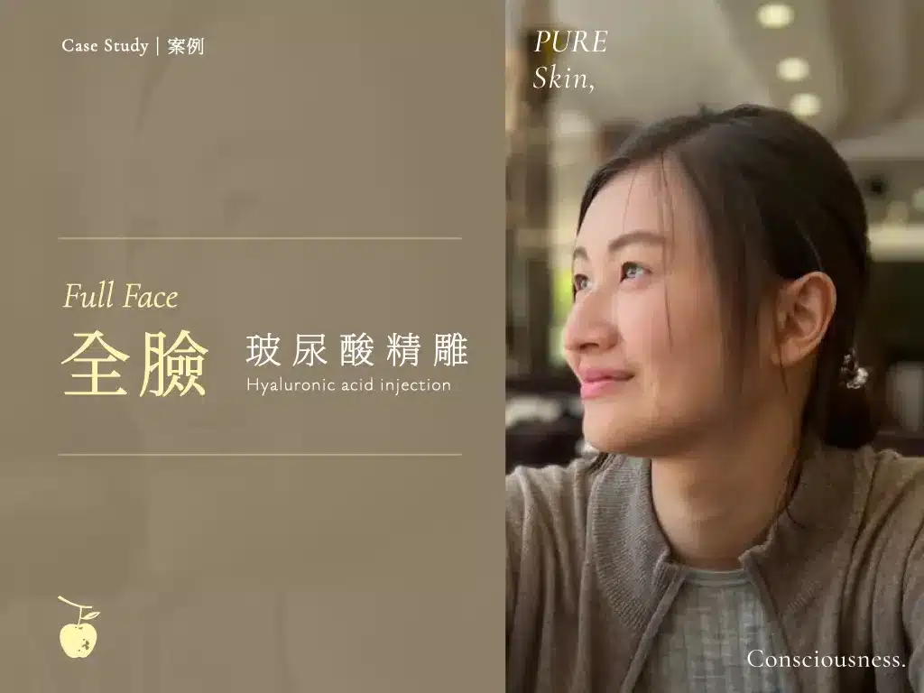 home casestudy fullface 01 金蘋果美學診所｜歐家宏醫師