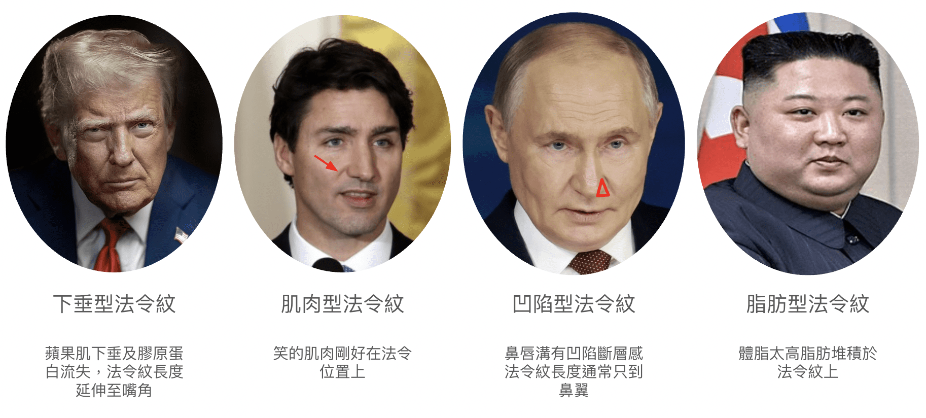 法令紋消除都沒效？4種不同類型法令紋改善方式