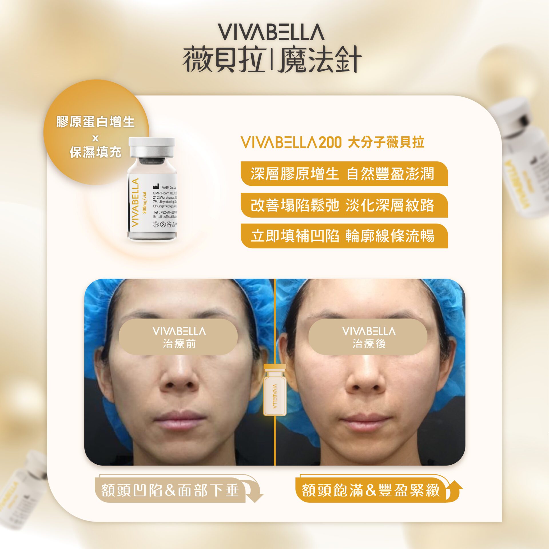 薇貝拉是臉頰凹陷新一代的超級剋星