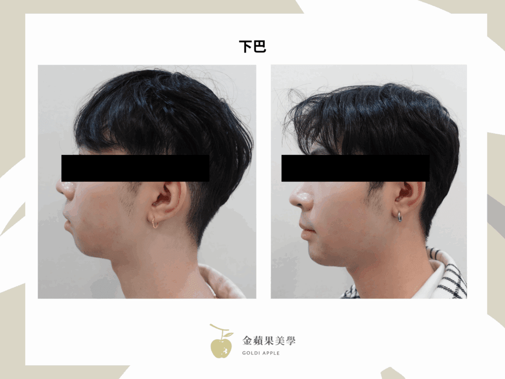 晶亮瓷下巴