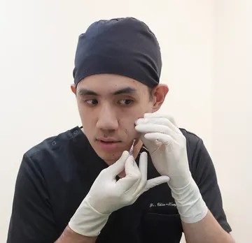 埋線拉提