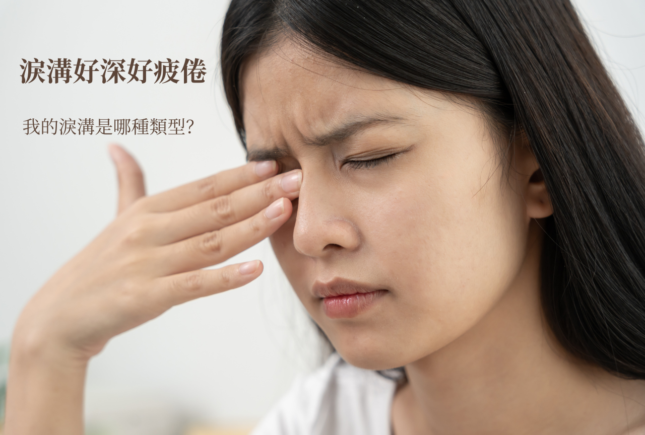 淚溝是什麼?認識3種淚溝類型,教你淚溝該怎麼消?