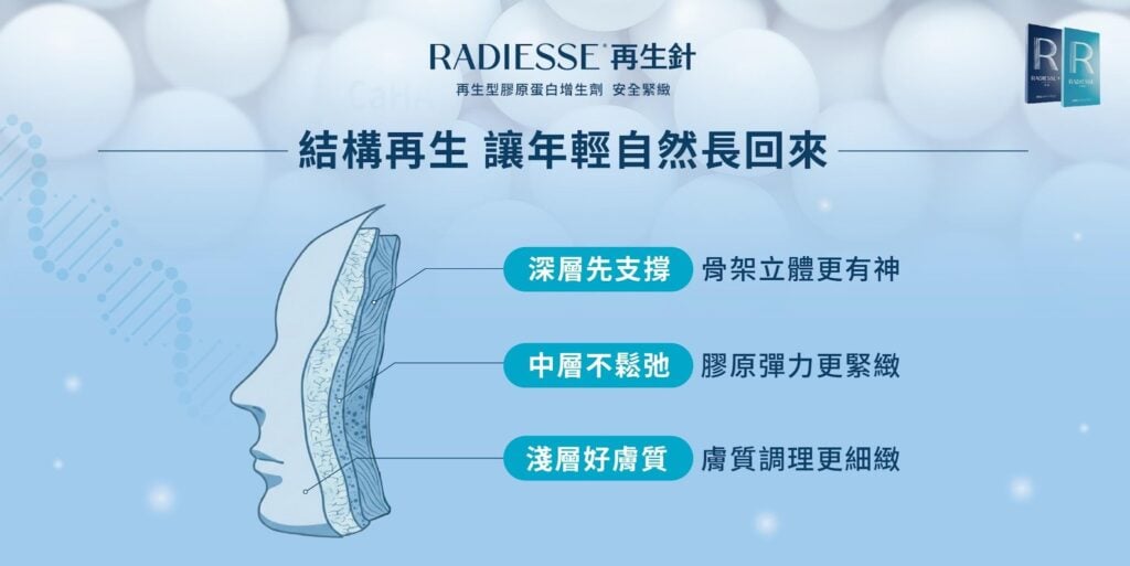 再生針