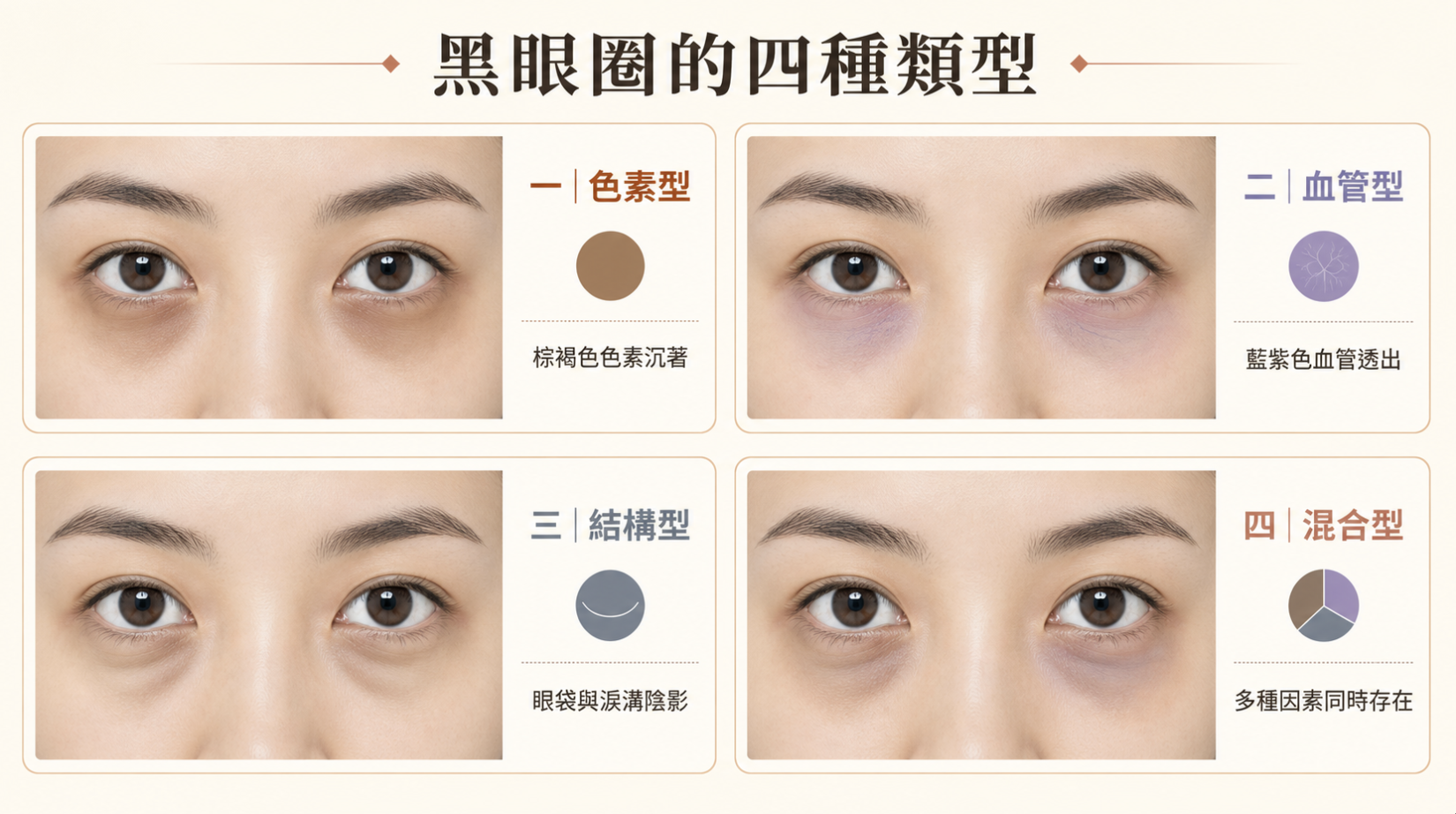 4種類型黑眼圈醫美如何補救？熊貓針有效嗎？