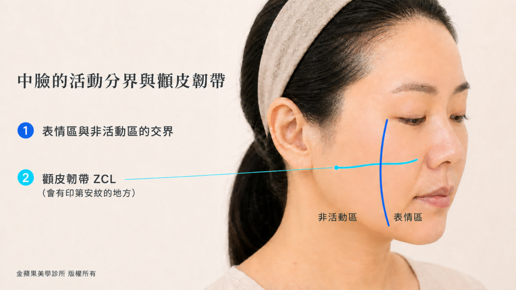 醫美埋線