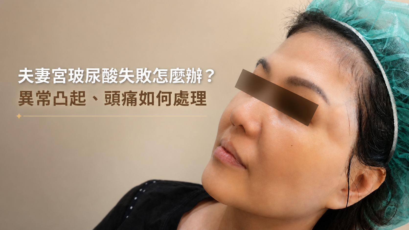 夫妻宮玻尿酸後遺症有哪些?填充太多凸起、頭痛原因與處理方式