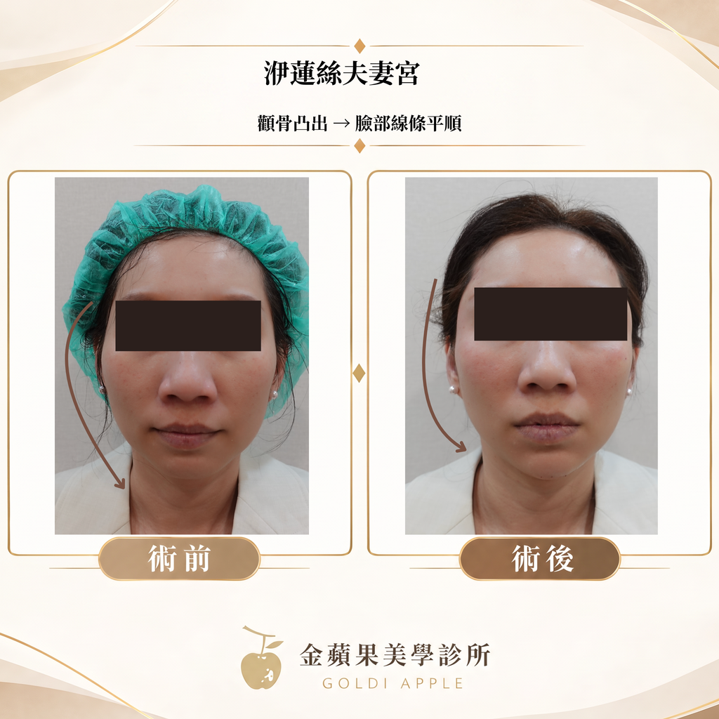 洢蓮絲夫妻宮