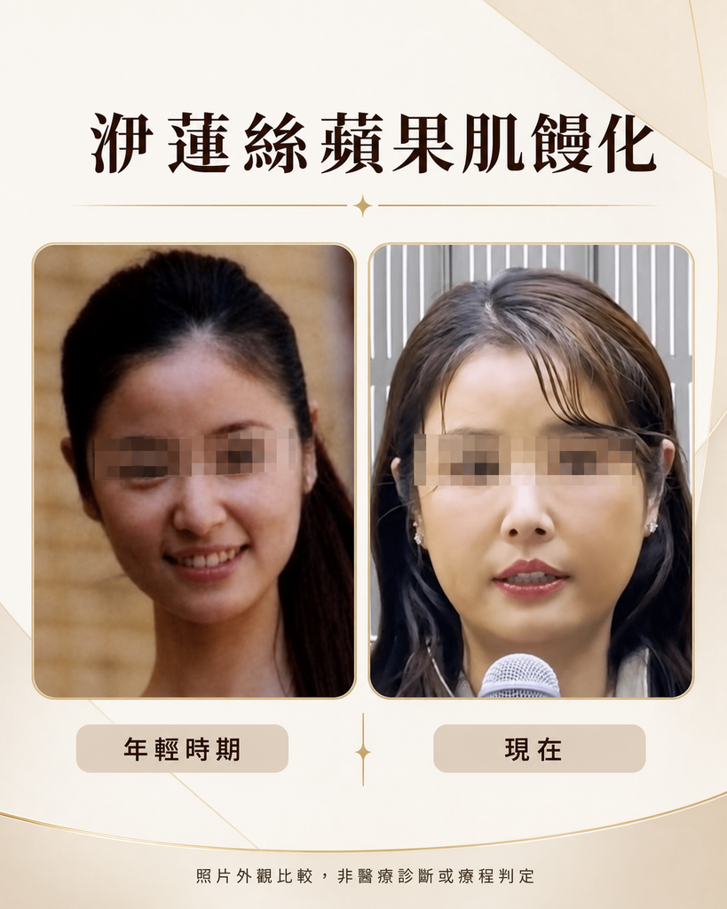 洢蓮絲饅化