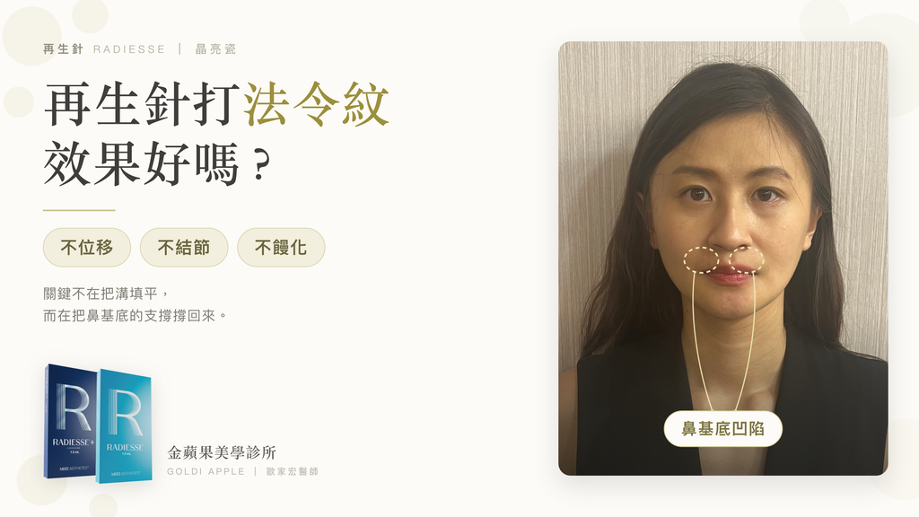 再生針法令紋