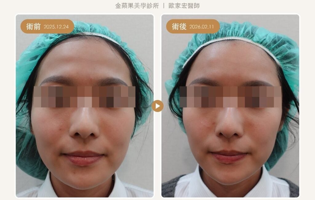 晶亮瓷額頭